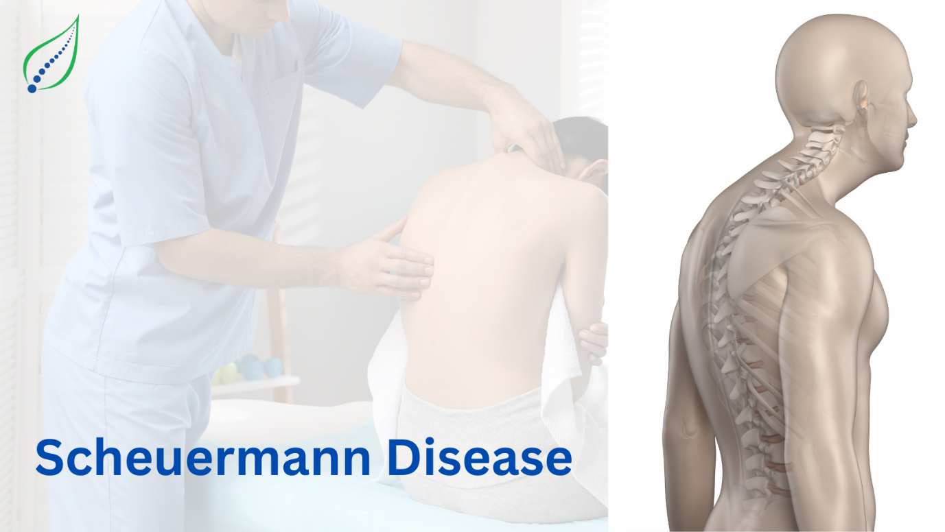Scheuermann Disease